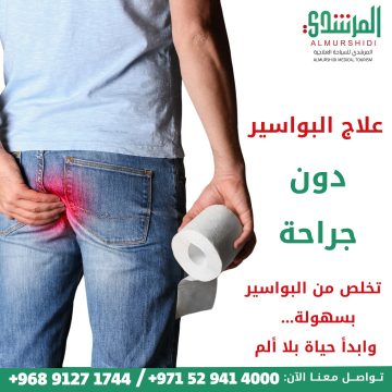 علاج البواسير