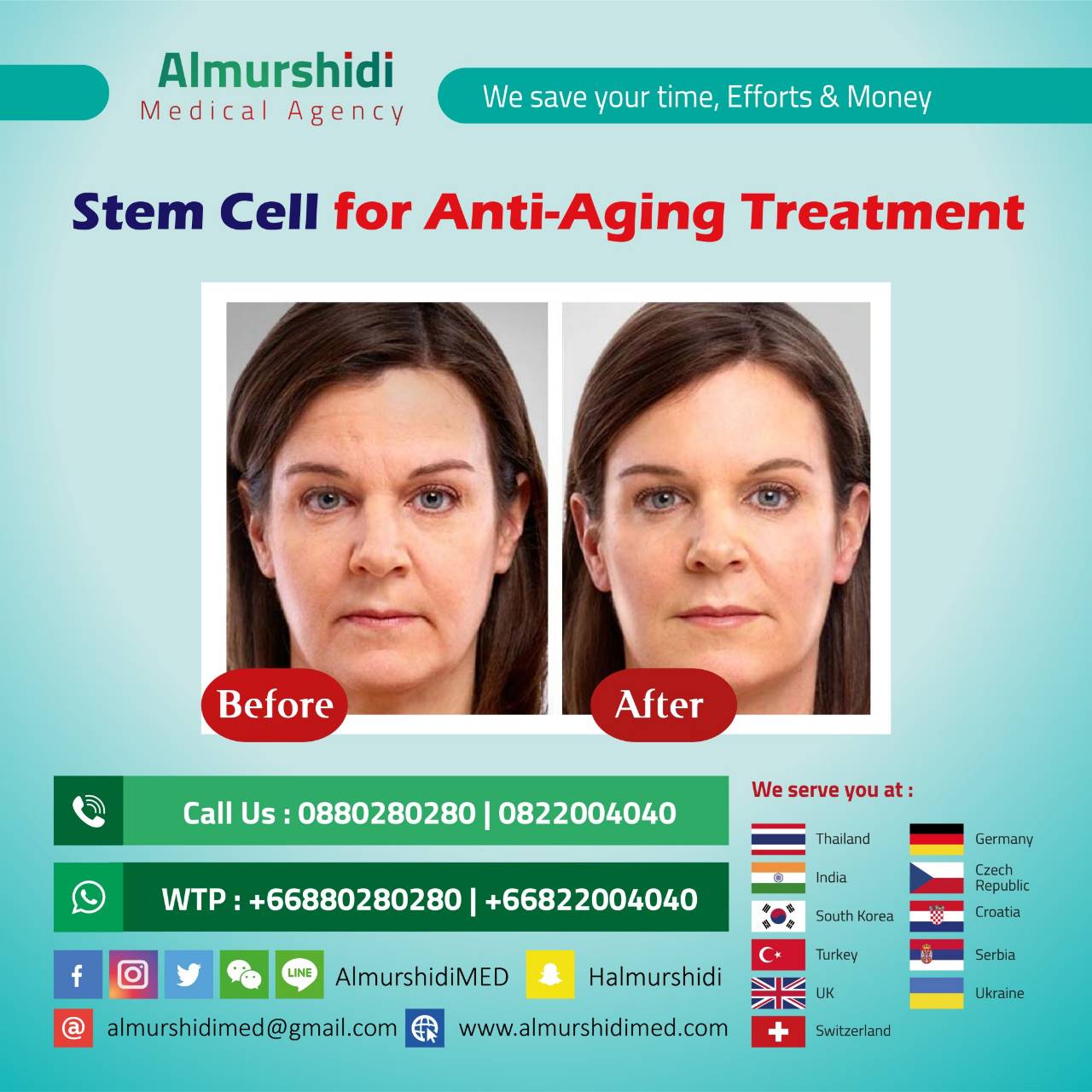 Prp Stemcell Anti Aging Therapy Bangkok Thailand Almurshidi Medical