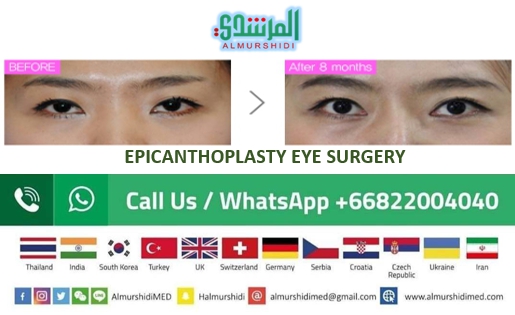eye enlargement surgery