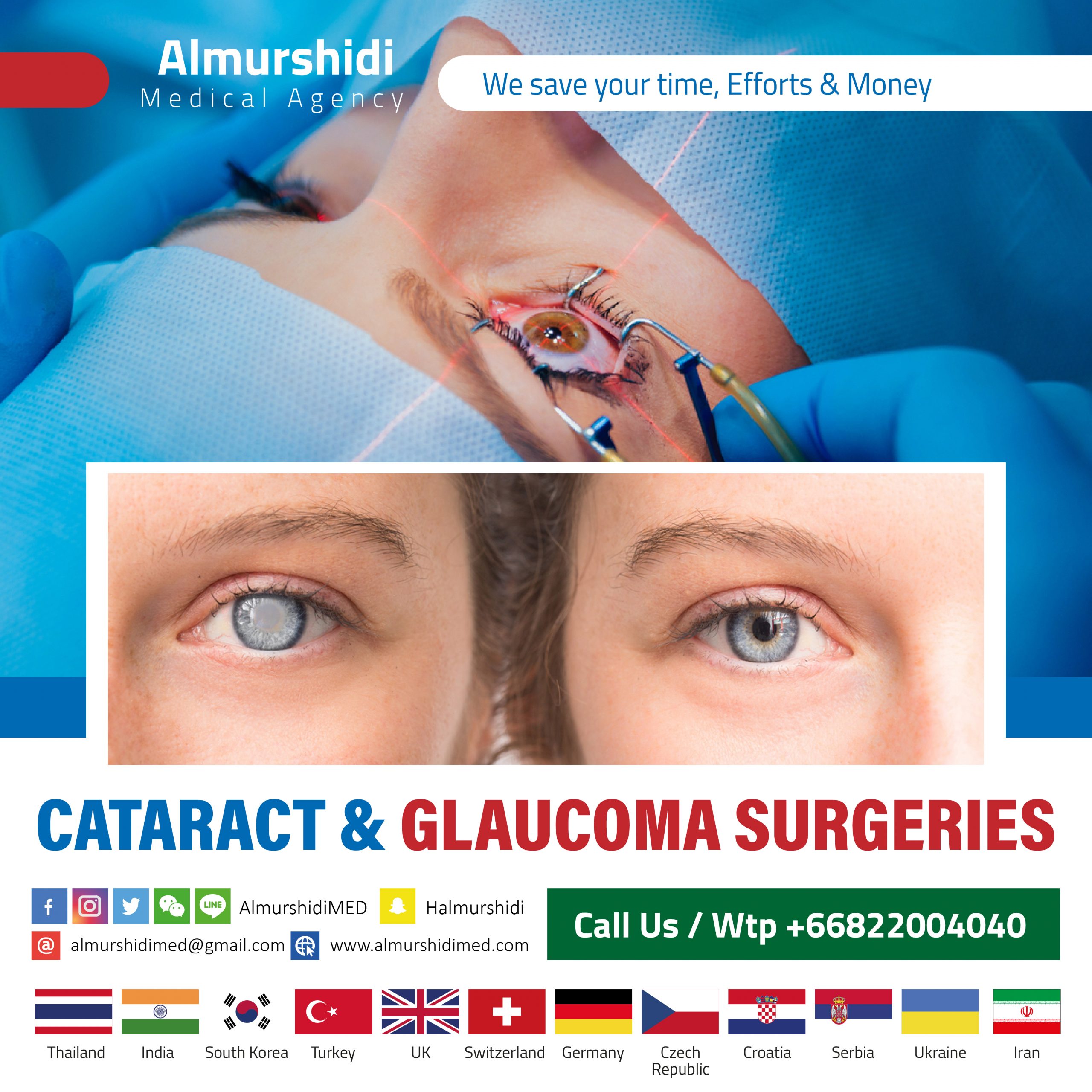 Best Cataract and Treatment and Surgery in