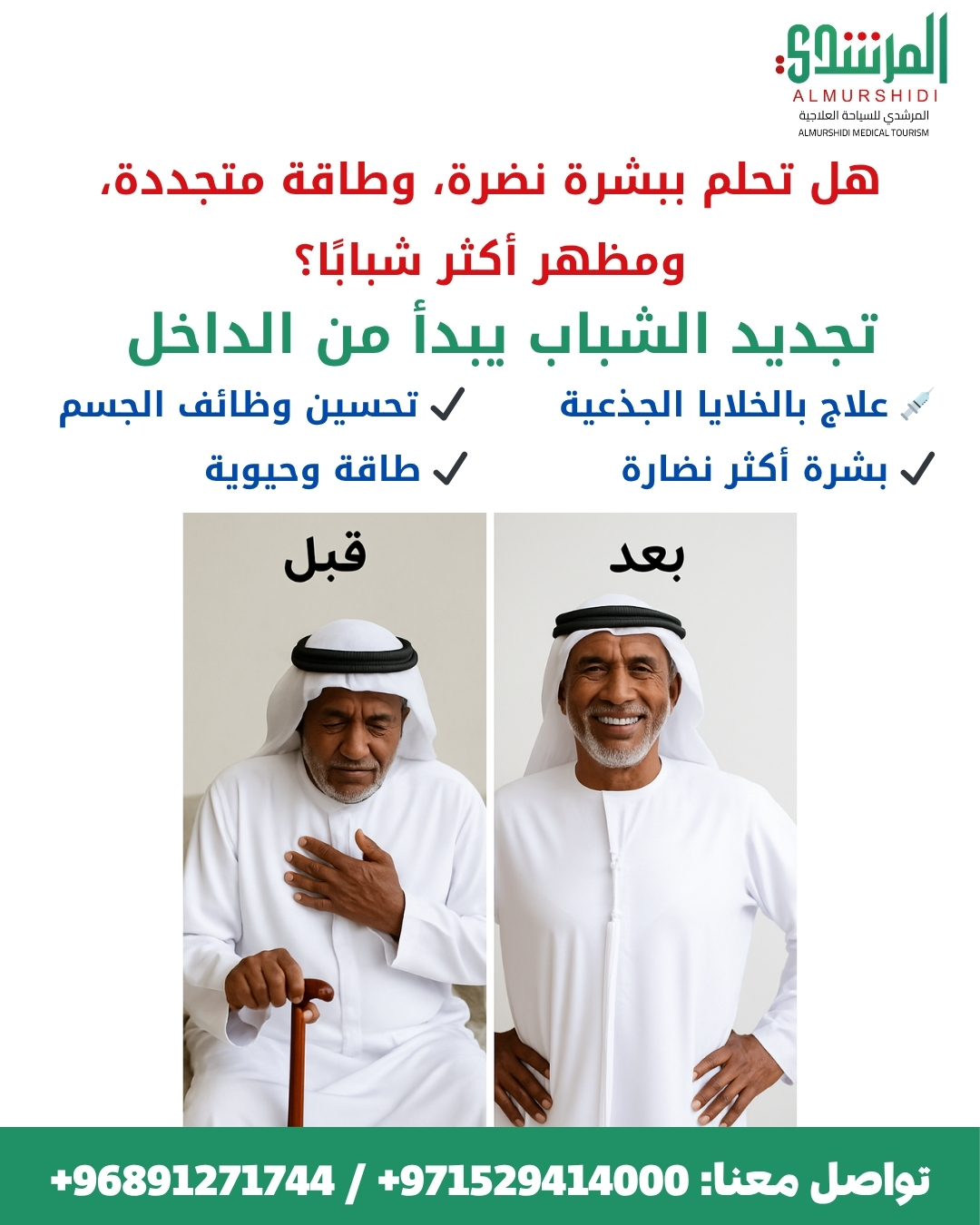 العلاج بالخلايا الجذعية