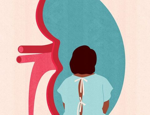 الفشل الكلوي