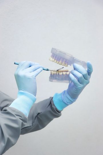 زراعة الأسنان
