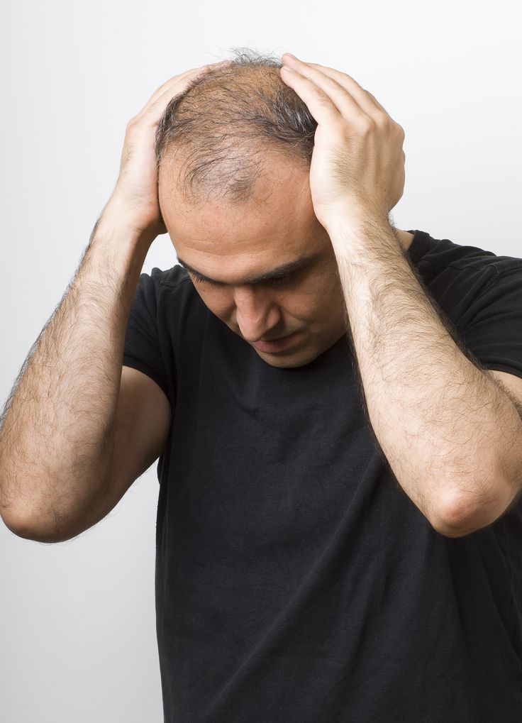 الصداع النصفي