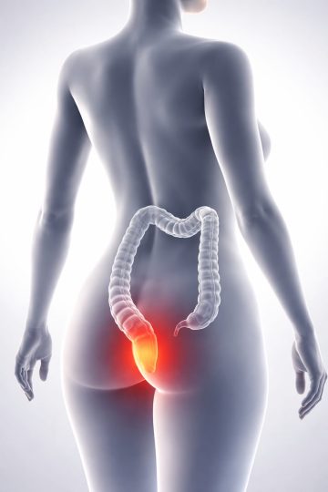 علاج البواسير