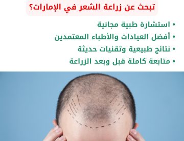 زراعة الشعر في الإمارات