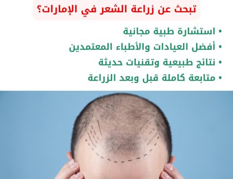 زراعة الشعر في الإمارات