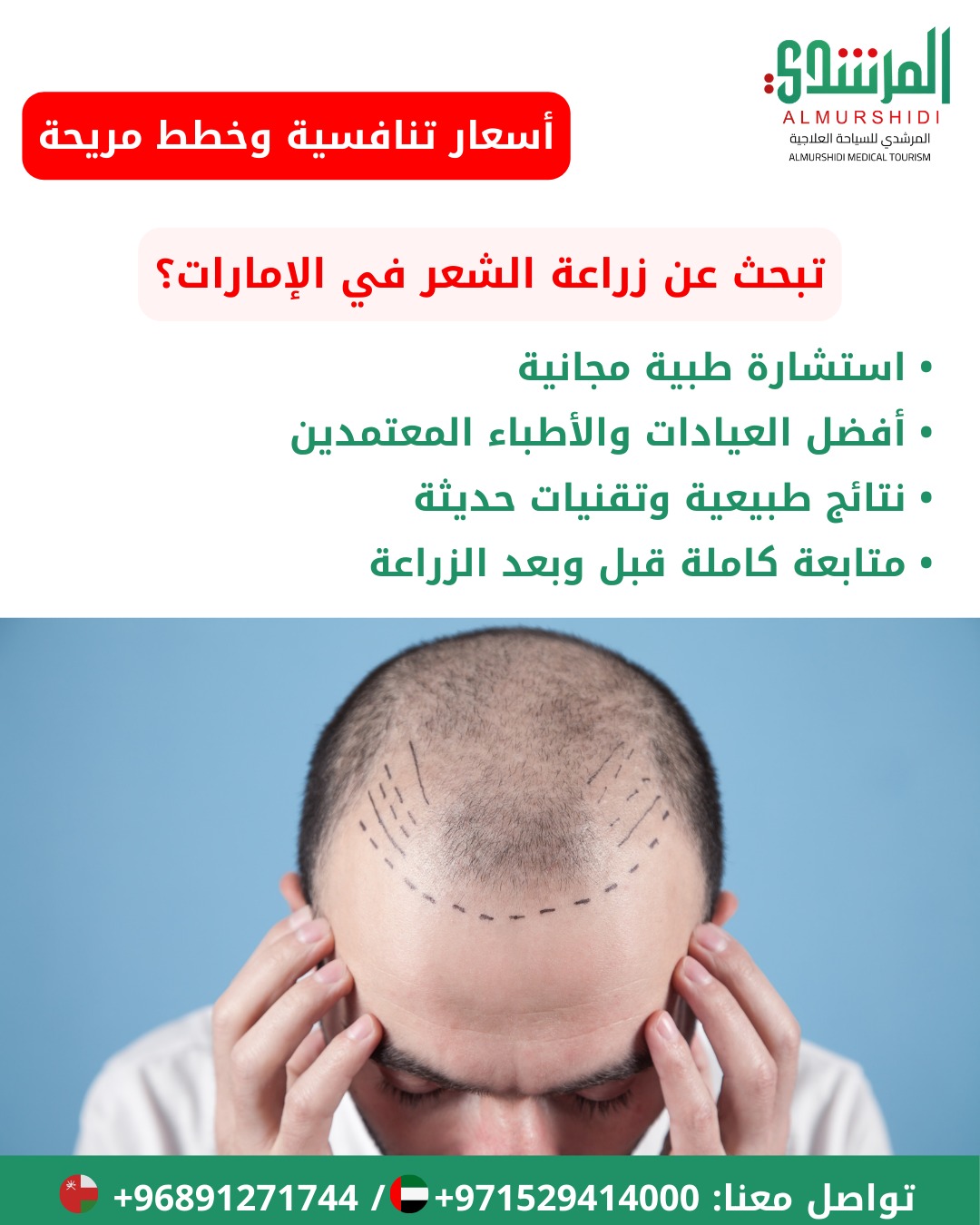 زراعة الشعر في الإمارات