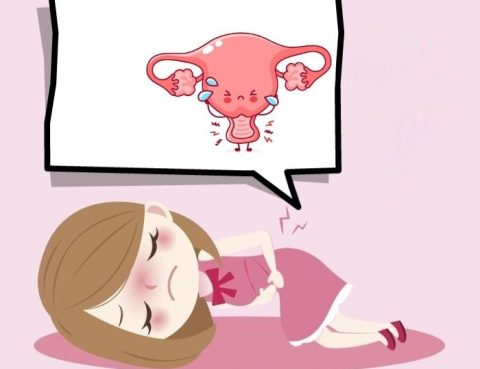 تكيس المبايض