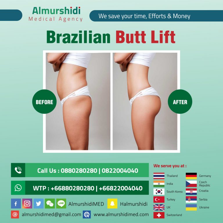 A Brazilian butt lift is a specialized fat transfer procedure that augments...