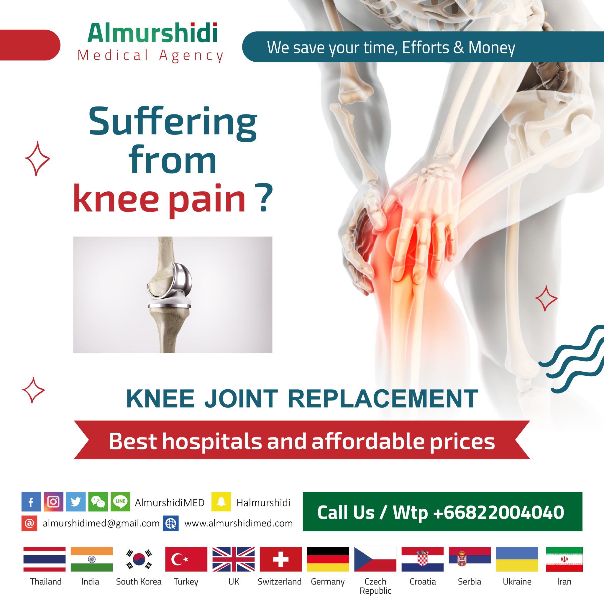 Best Knee Joint Replacement Surgery Cost Almurshidi Medical Tourism