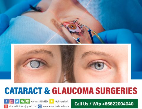 Best Cataract and Glaucoma Treatment and Surgery