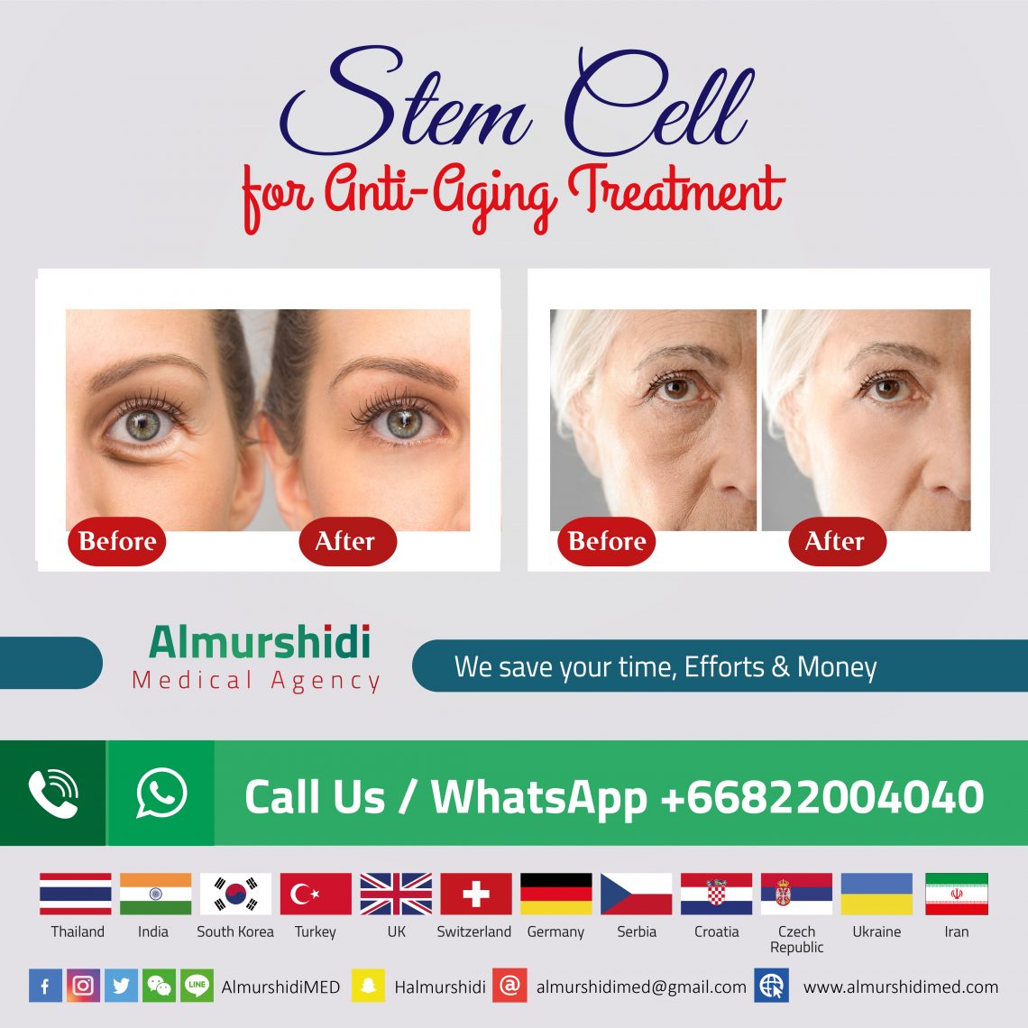 Best Anti Aging Stem Cell Therapy Package Price