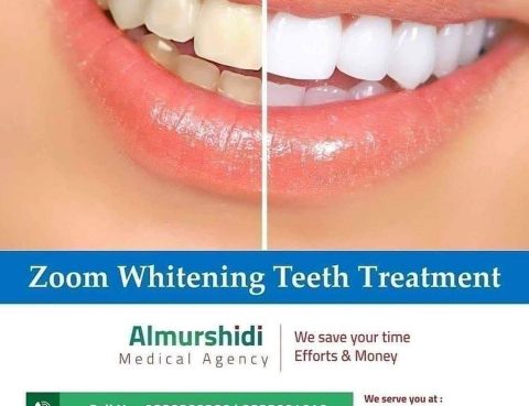 Best Zoom Teeth Whitening in Thailand