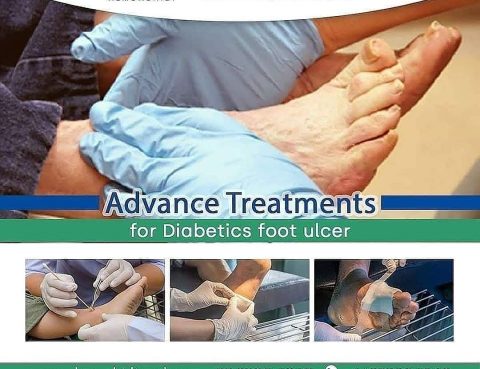 Diabetic Foot Ulcer Diagnosis and Treatment in Thailand