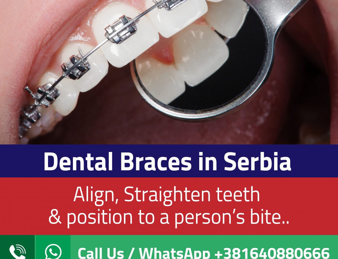 Dental Braces Cost Archives Almurshidi Medical Tourism Best