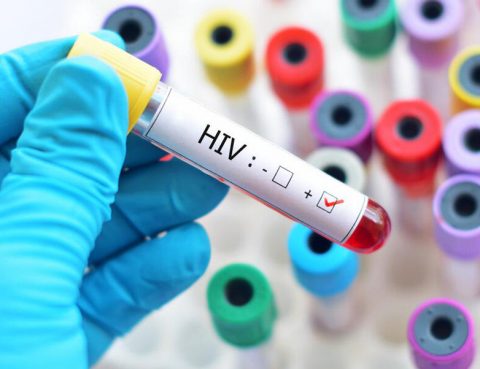 HIV Diagnosis and Treatment in Thailand