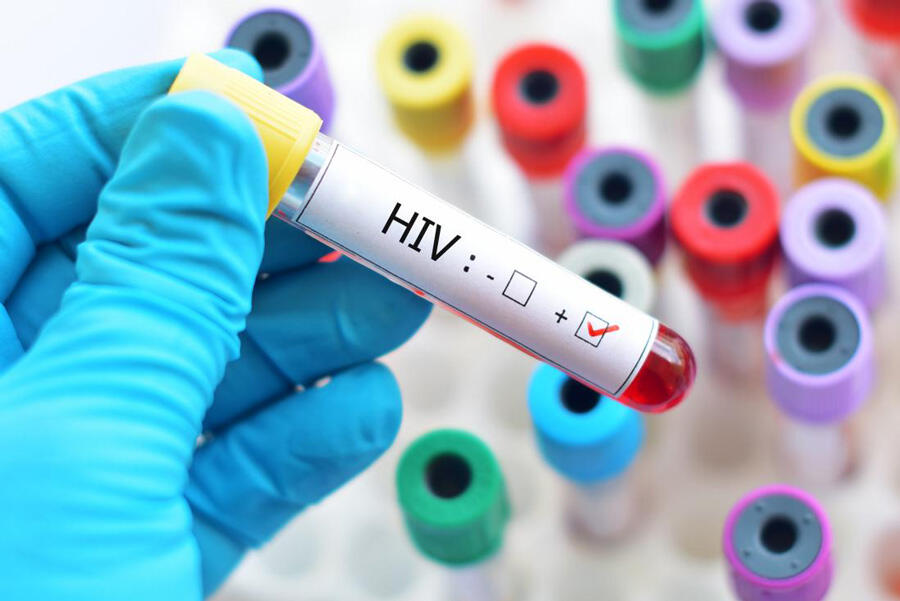 HIV Diagnosis and Treatment in Thailand