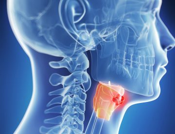 Laryngeal Cancer Diagnosis and Treatment in Thailand