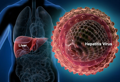 Hepatitis Diagnosis and Treatment in Thailand