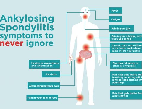 Ankylosing Spondylitis Treatment in Thailand