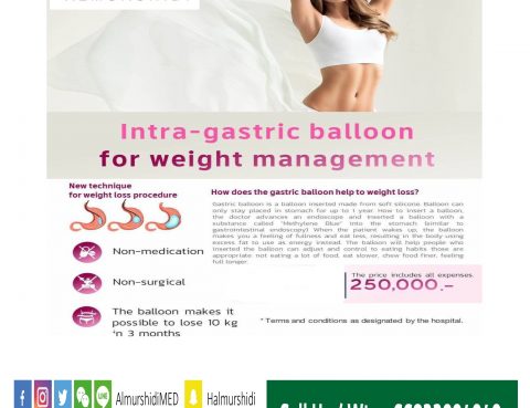 Intragastric Balloon for Weight Management in Thailand