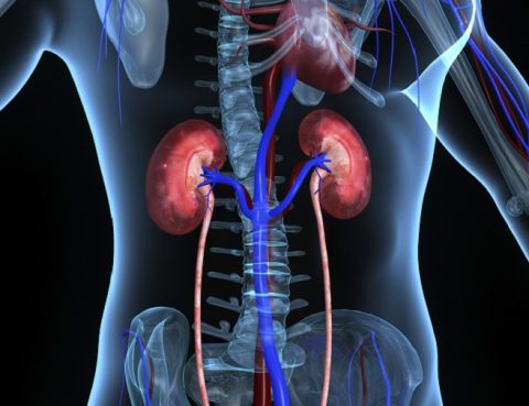 Kidney Stones Treatment in Thailand