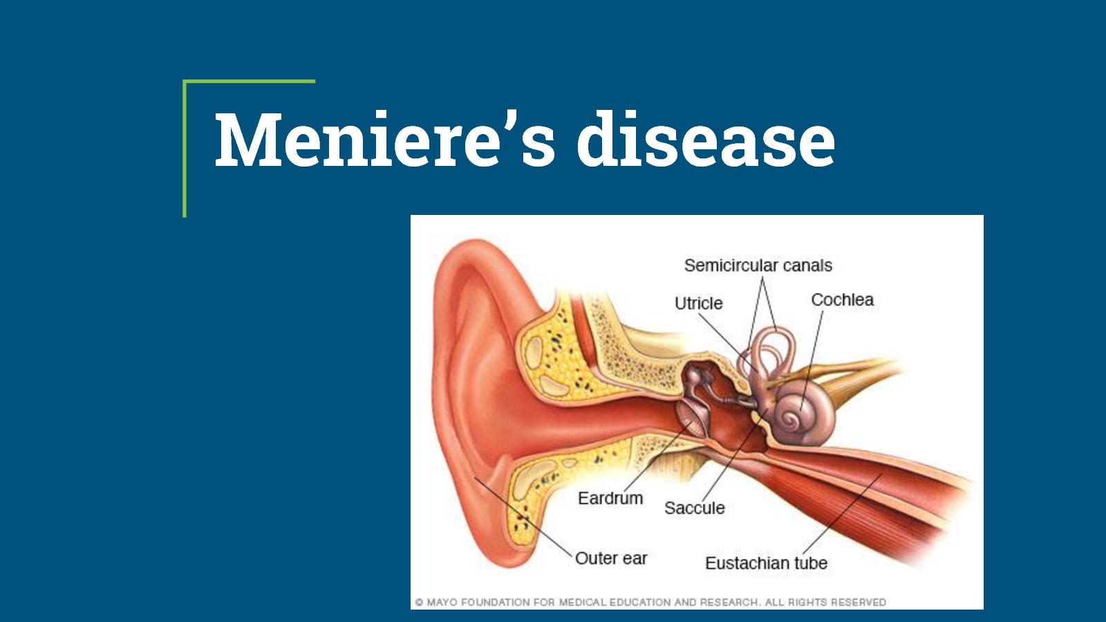 menieres-disease-treatment-in-thailand-almurshidi-medical-tourism