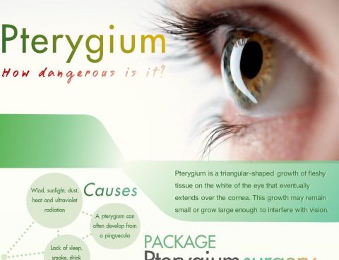 Pterygium Diagnosis and Treatment in Thailand