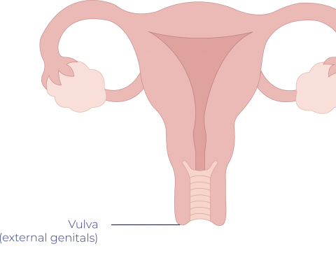 Vulvar Cancer Treatment in Thailand