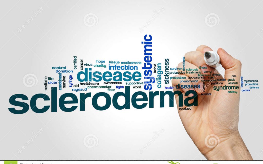 Scleroderma Treatment in Thailand