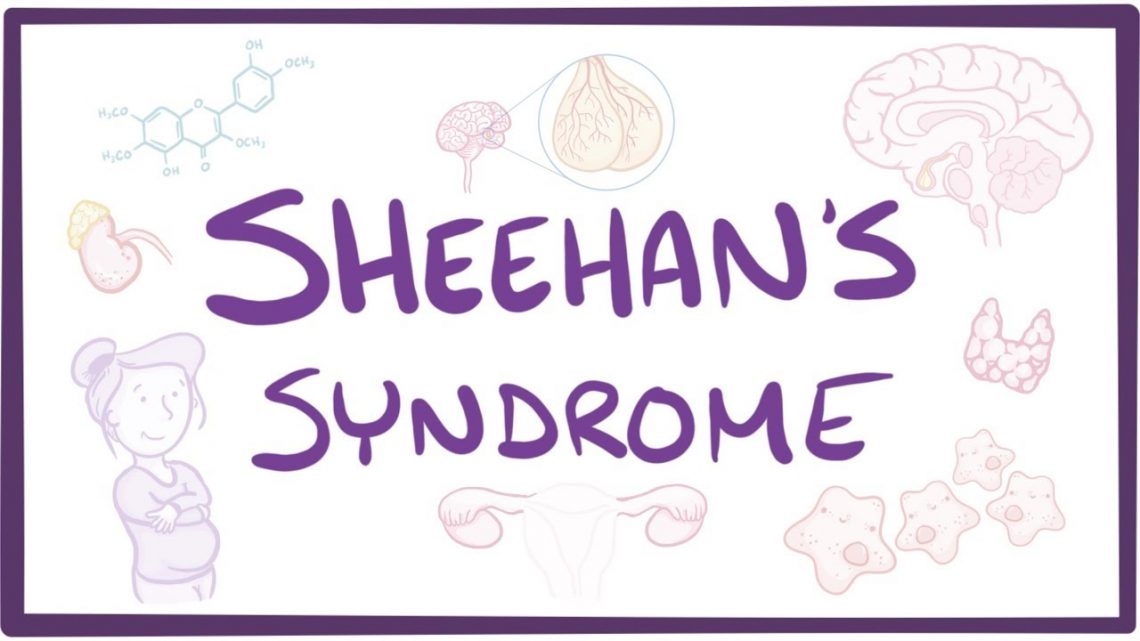 Sheehan Syndrome Treatment in Thailand