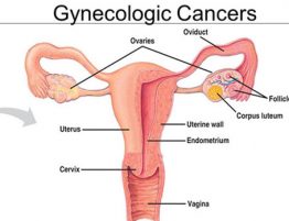 Gynecologic Cancers Treatment in Thailand