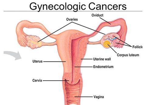 Gynecologic Cancers Treatment in Thailand