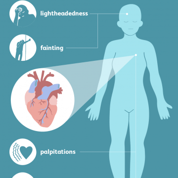 Arrhythmia