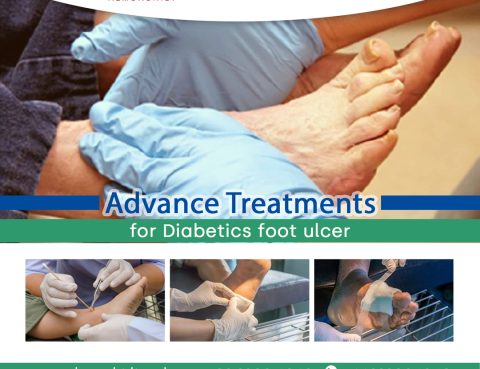 diabetes foot ulcers