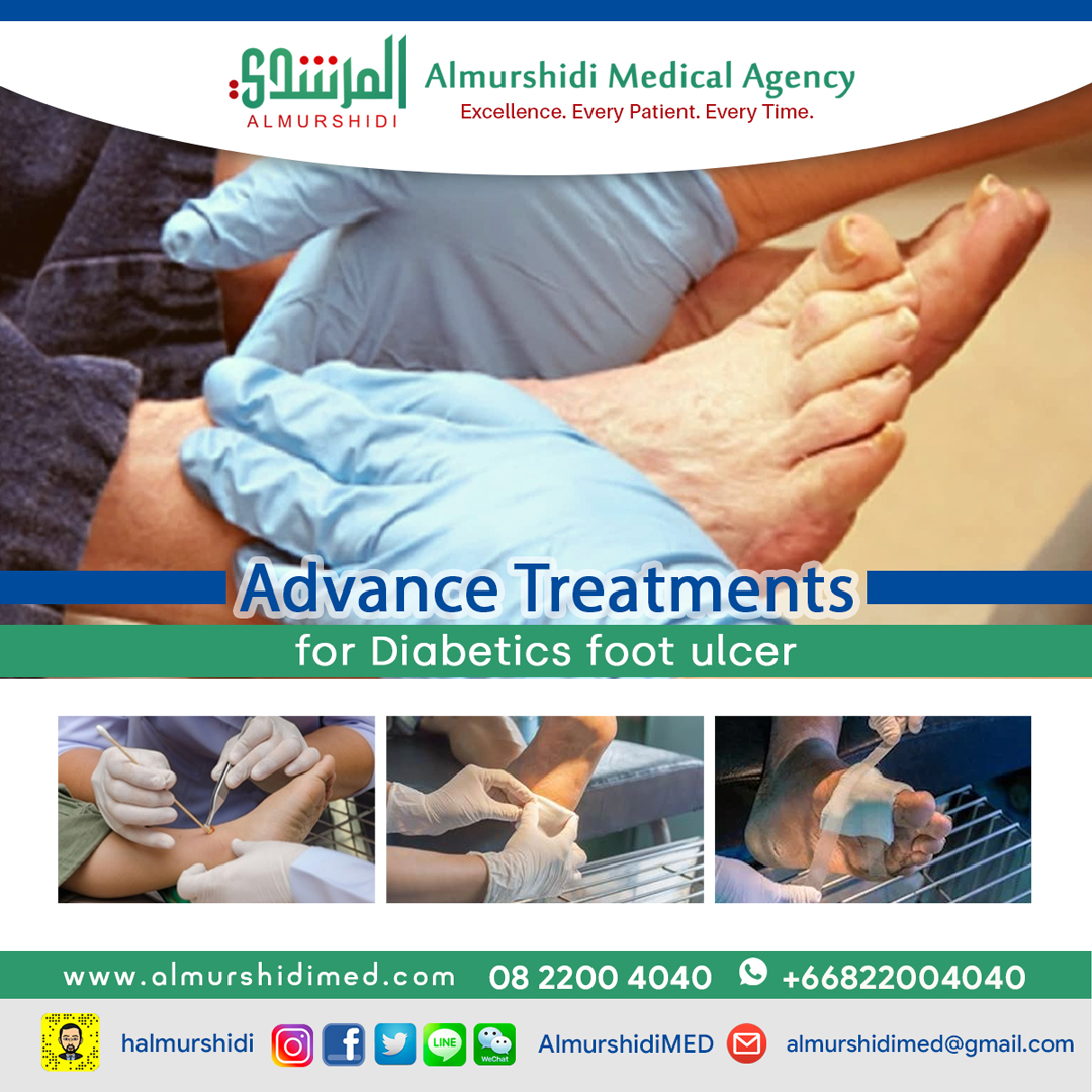 diabetes foot ulcers