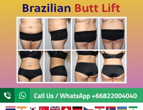 Brazilian _Butt_lift