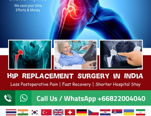 hip replacement surgery