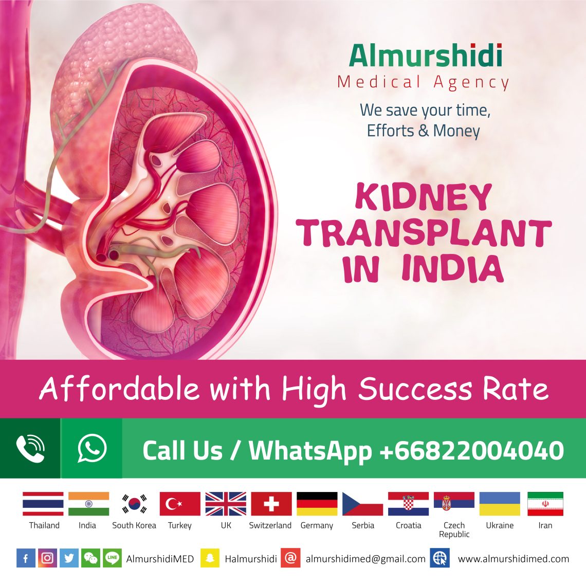 kidney transplant