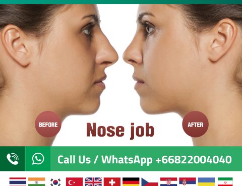 nose job