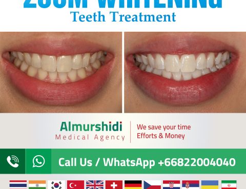 zoom whitening teeth