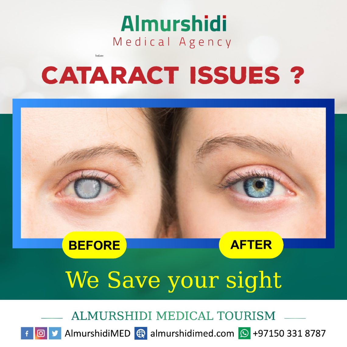 cataract issues