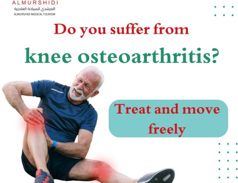 Knee Osteoarthritis