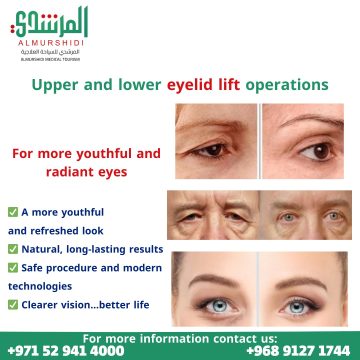 Eyelid Lift Surgery