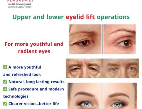 Eyelid Lift Surgery