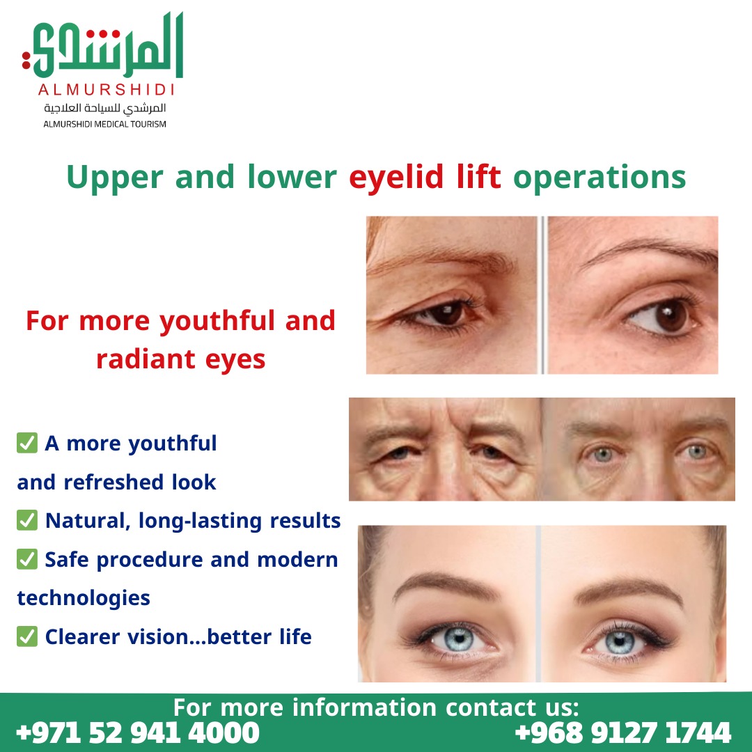 Eyelid Lift Surgery