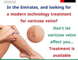 Varicose Vein Treatment