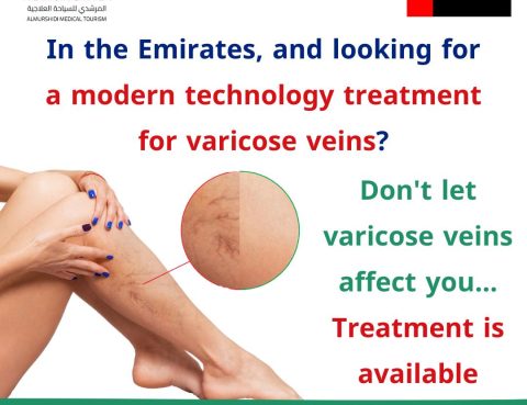 Varicose Vein Treatment