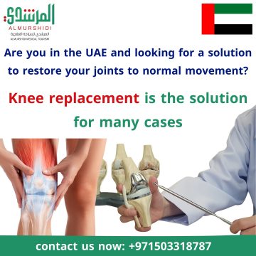 knee replacement